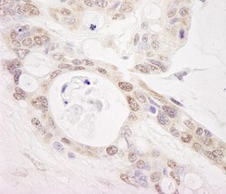 PUS1 Antibody, Novus Biologicals 0.1mL; Unlabeled:Antibodies, Polyclonal